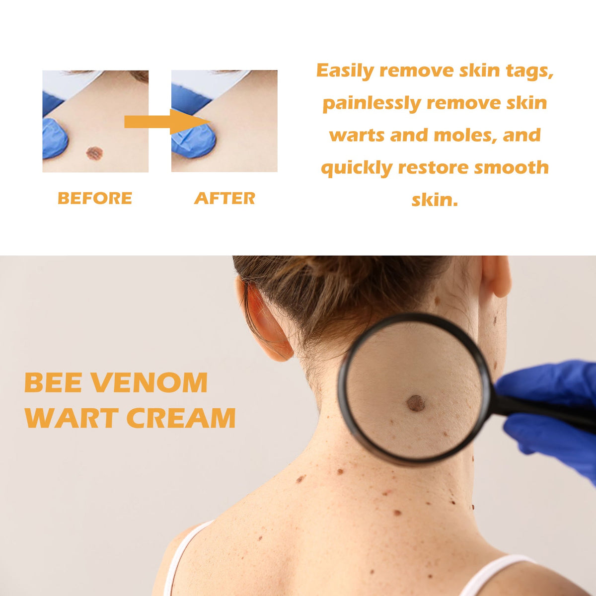 Bee venom wart cream smooth skin care positioning