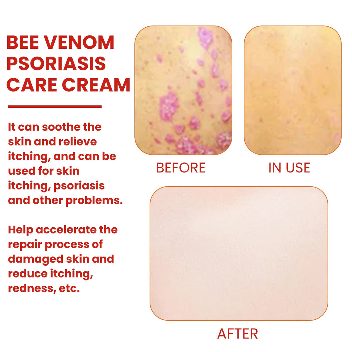 Skin comfort cream with mint leaf oil