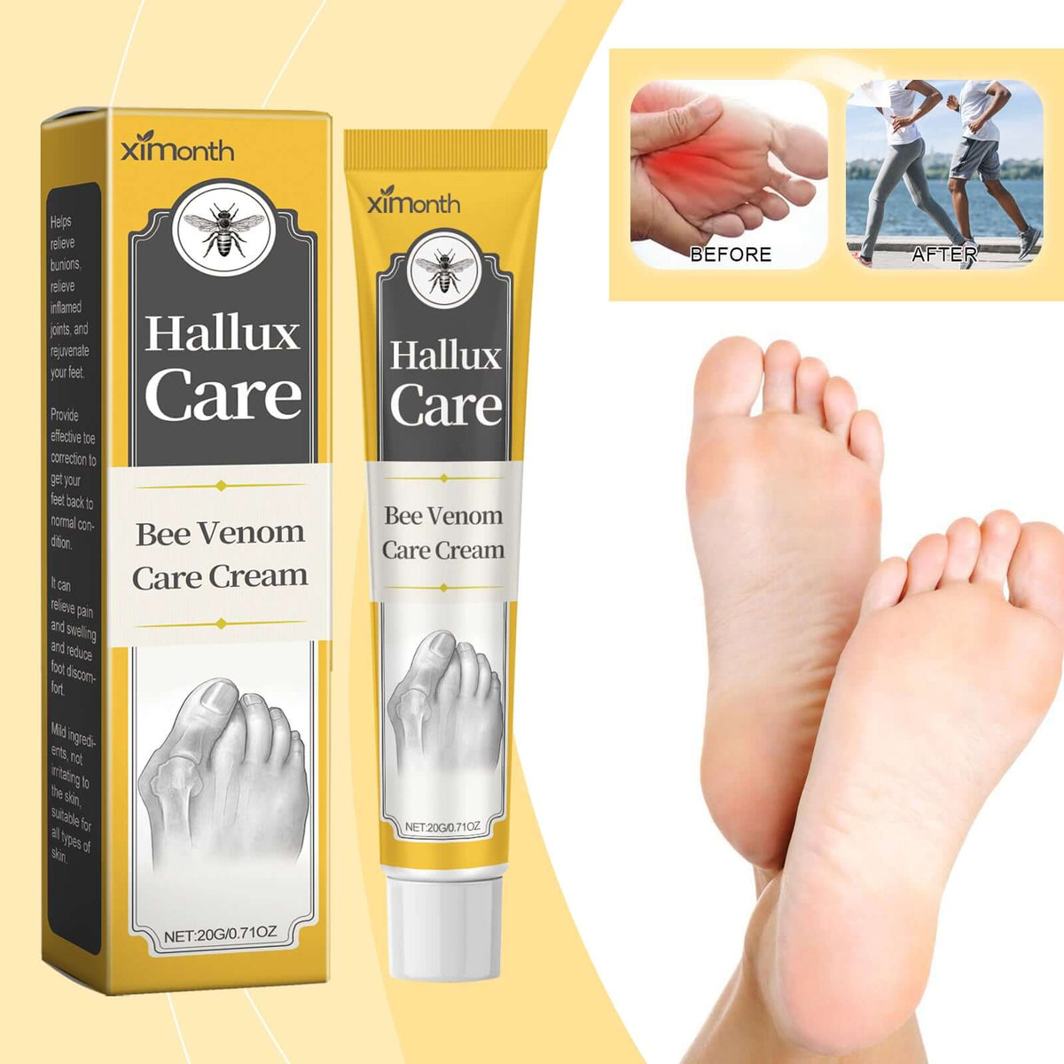 XIMONTHS 20g Hallux Care bee venom cream for targeted foot massage.